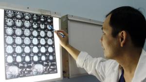 Bệnh viện Trường Đại học Y Dược Huế chữa động kinh bằng phẫu thuật cho một bệnh nhân